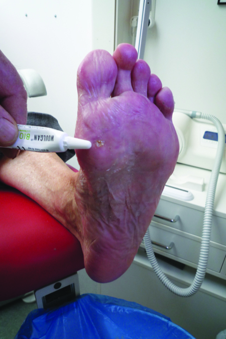 Die Klinik nach der Behandlung der Hämorrhoide in witebske
